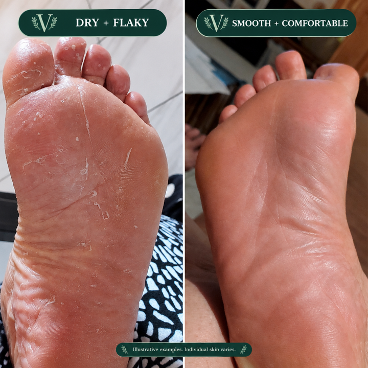 VYNE daily cleansing routine